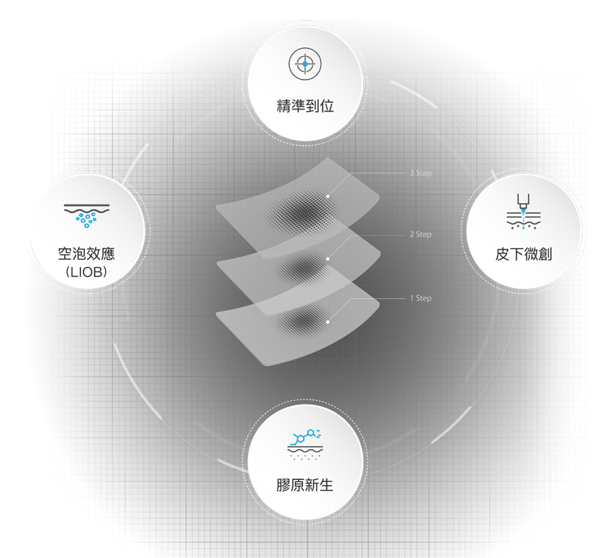 5.三段式聚焦技術